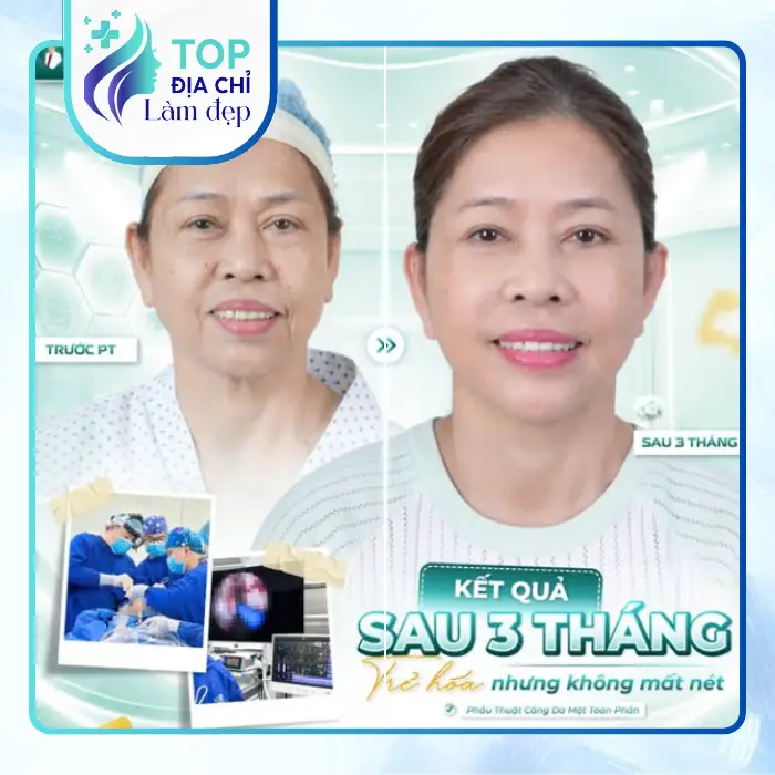 Khám Phá Top 5 Cơ Sở Căng Da Mặt Tại Đắk Lắk