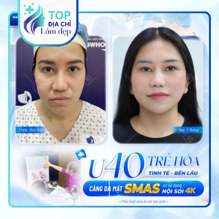 Khám Phá Top 5 Cơ Sở Căng Da Mặt Tại Đắk Lắk