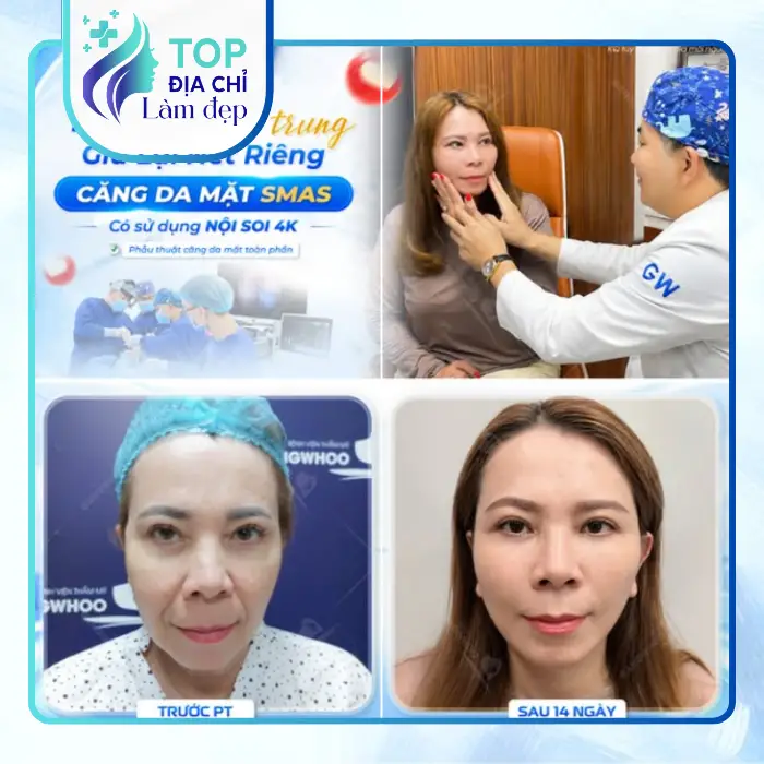 Top 5 Địa Chỉ Căng Da Mặt Tại Đồng Nai và những lưu ý trước khi thực hiện
