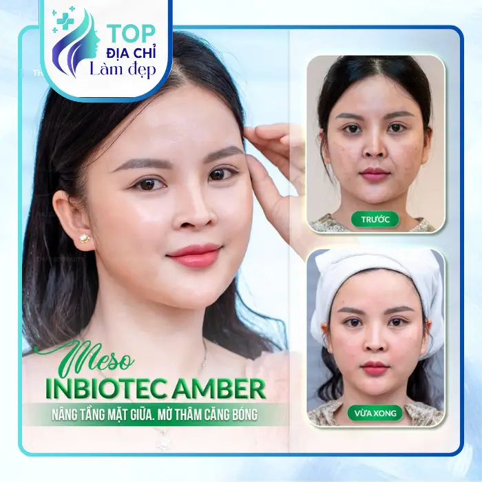 7 Địa Chỉ Căng Da Mặt Tại Hà Nội Chất Lượng Hiện Nay