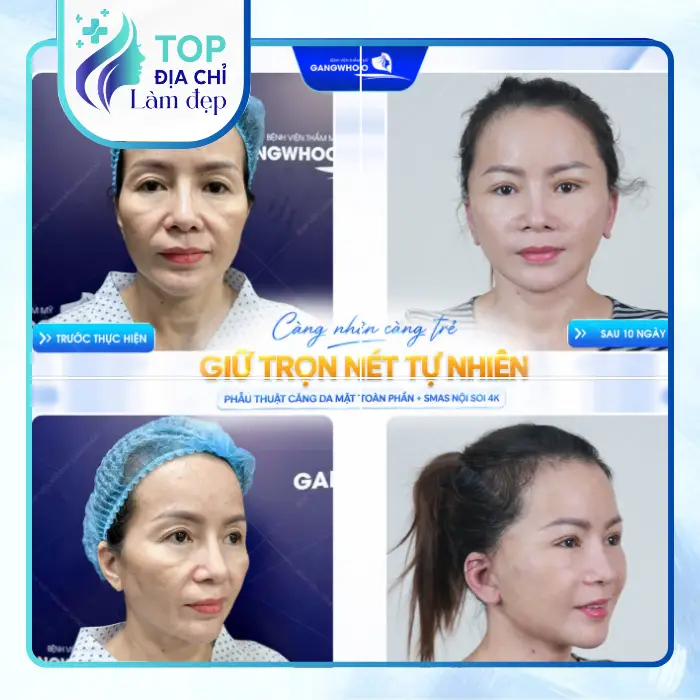 Review Top 4 Địa Chỉ Căng Da Mặt Tại Hải Dương Đáng Cân Nhắc