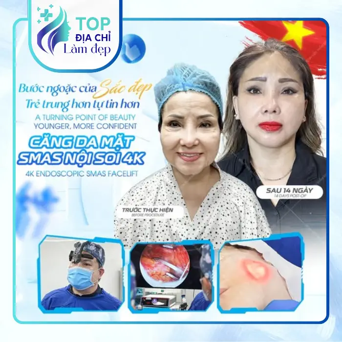 Căng Da Mặt Tại TPHCM Ở Đâu Uy Tín? Top 6 Địa Chỉ Kèm Bảng Giá Tham Khảo 2026