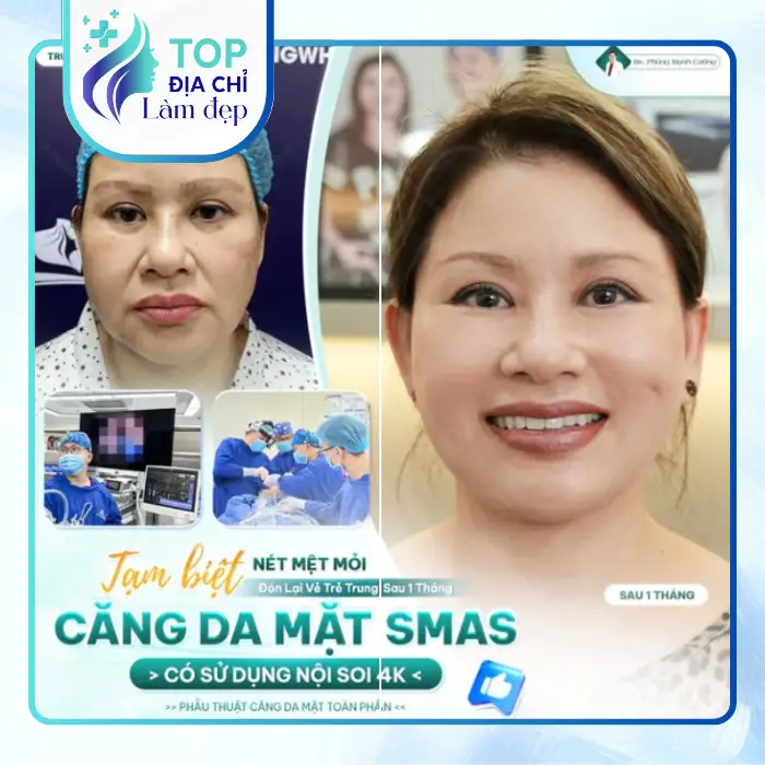 Căng Da Mặt Tại Quận 4 – Tham Khảo 5 Địa Chỉ Trẻ Hóa Khuôn Mặt