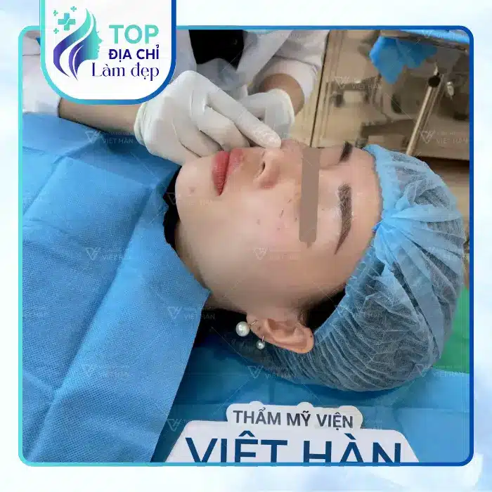 Căng Da Mặt Tại Thanh Hóa Gợi Ý 7 Địa Chỉ Trẻ Hóa Da Không Phẫu Thuật