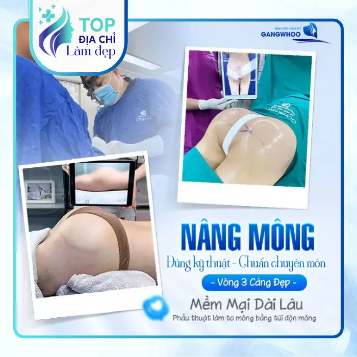 Nâng Mông Tại Bình Phước – Gợi Ý 7 Địa Chỉ Lân Cận Để Tham Khảo