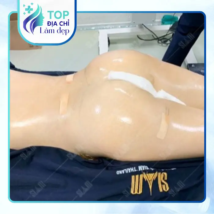 Nâng Mông Tại Bình Thuận – Gợi Ý 5 Địa Chỉ Lân Cận Có Thể Tham Khảo
