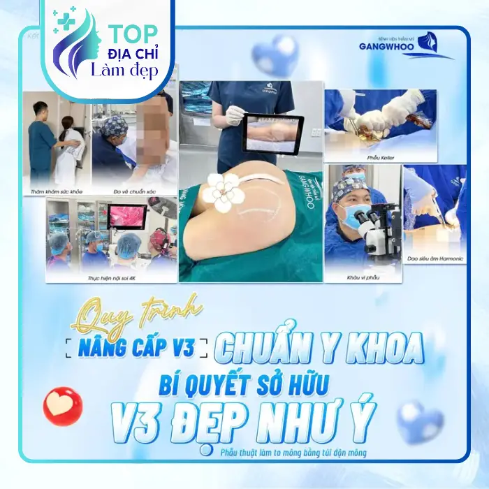 Nâng Mông Tại Gò Vấp – Gợi Ý 5 Cơ Sở Để Tham Khảo