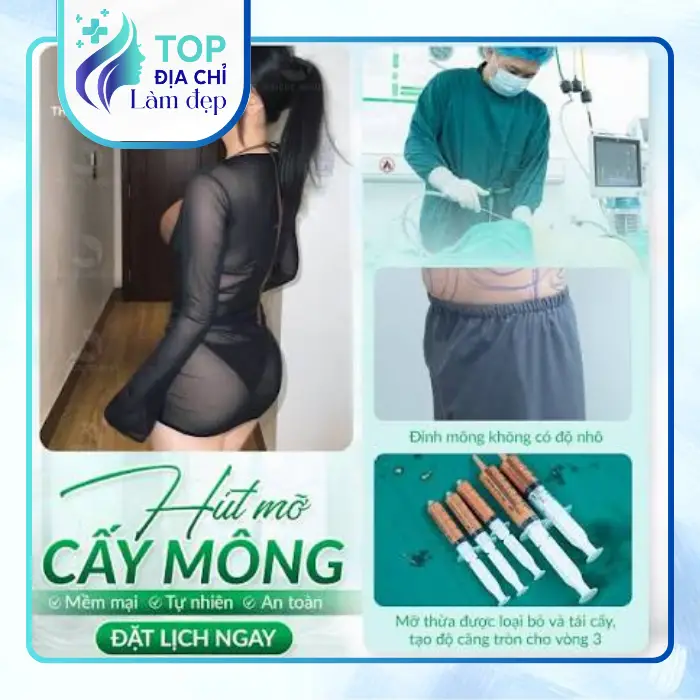 Nâng Mông Tại Hải Dương – Gợi Ý 8 Cơ Sở Có Thể Tham Khảo