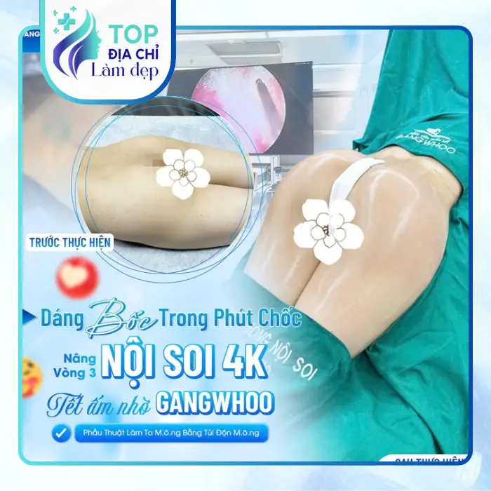 Nâng Mông Tại Nam Định – Gợi Ý 4 Cơ Sở Thẩm Mỹ Để Tham Khảo