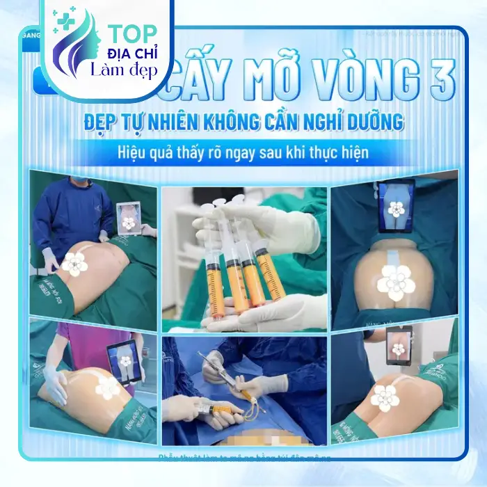 Nâng Mông Tại Quận 4 – Tham Khảo 6 Cơ Sở Có Thể Tìm Hiểu