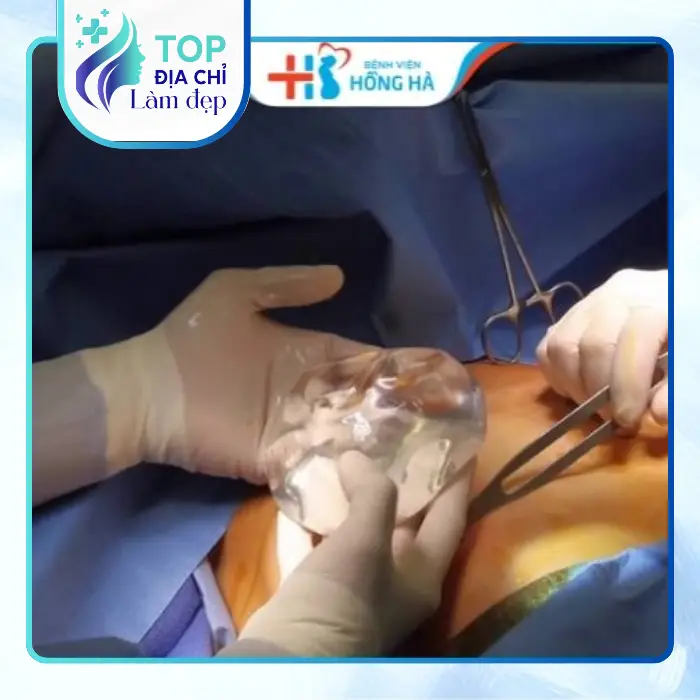 Nâng Mông Tại Quận 6 – Tham Khảo 7 Cơ Sở Tại TPHCM