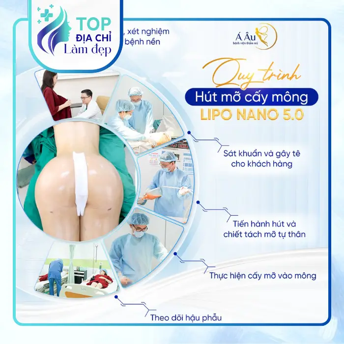 Nâng Mông Tại Quận 8 – Tham Khảo 6 Địa Chỉ Có Thể Tìm Hiểu