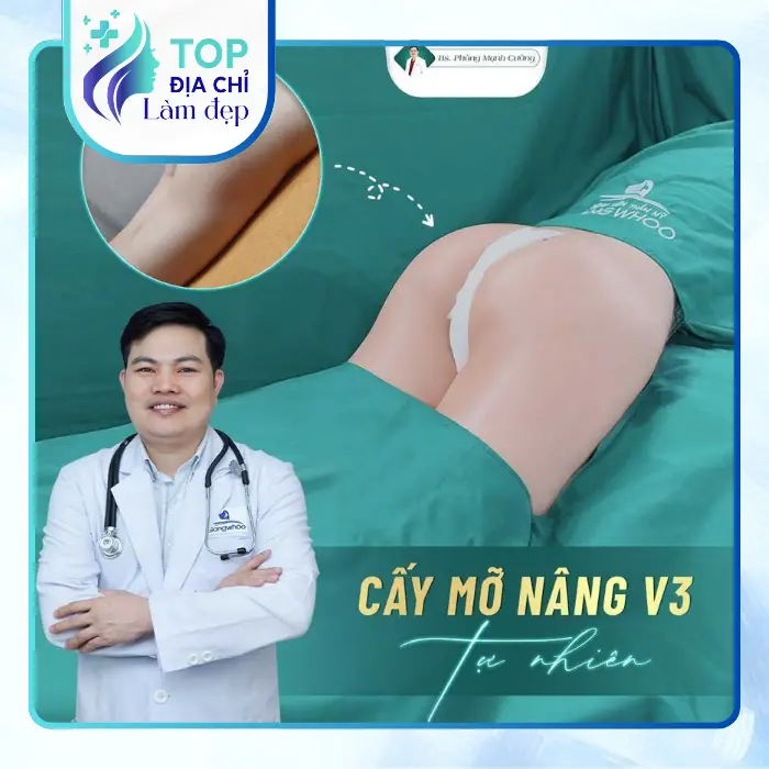 Nâng Mông Tại Quận Tân Phú – Tham Khảo 4 Địa Chỉ Tại TP.HCM