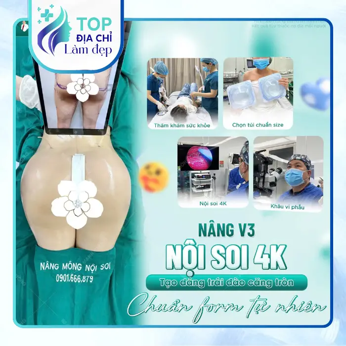 Nâng Mông Tại Thủ Đức – Gợi Ý 6 Địa Chỉ Để Tham Khảo